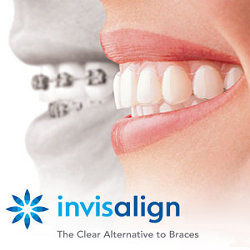 Invisalign logo