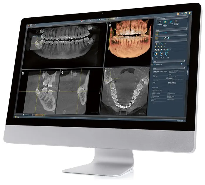 3d CT Cone Beam Scanner Images