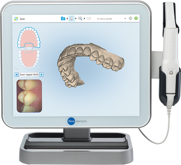 ITero™ Digital Scanning unit up close